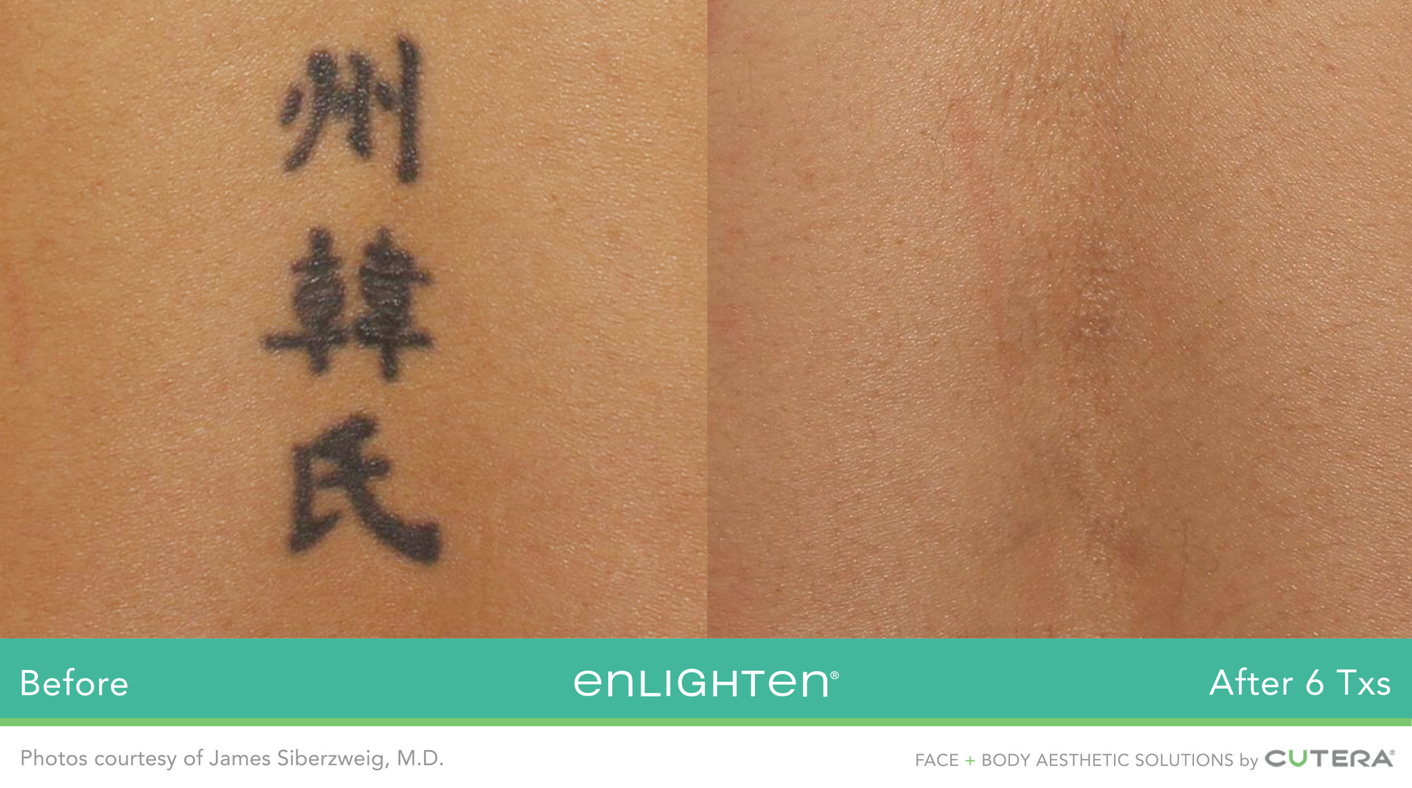 tatouage