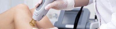 Laser esthétique et médical Toulouse